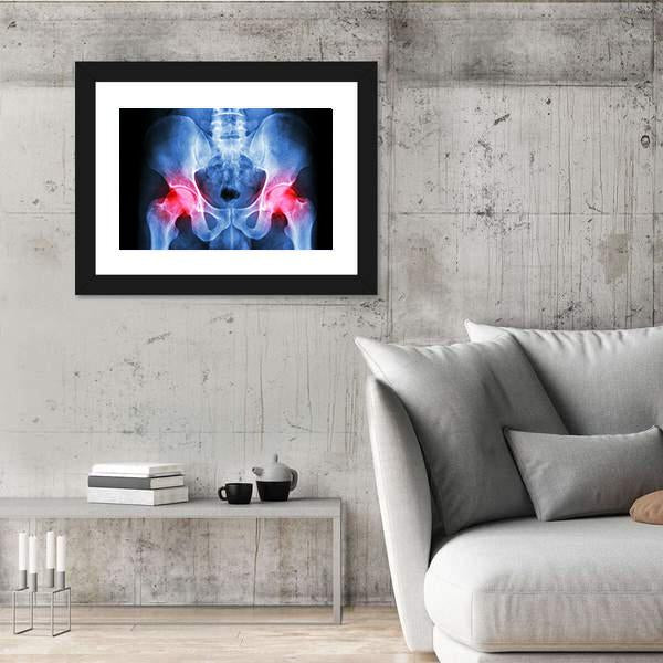 X-Ray Of Pelvis Canvas Wall Art-5 Horizontal-Gallery Wrap-22" x 12"-Tiaracle