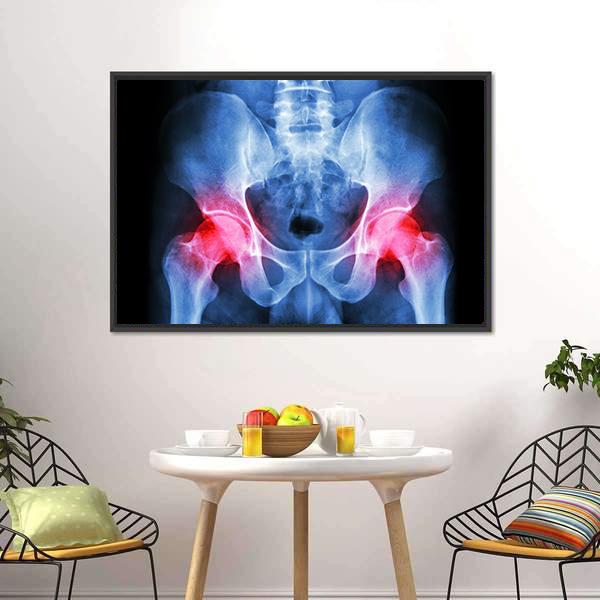 X-Ray Of Pelvis Canvas Wall Art-3 Horizontal-Gallery Wrap-25" x 16"-Tiaracle