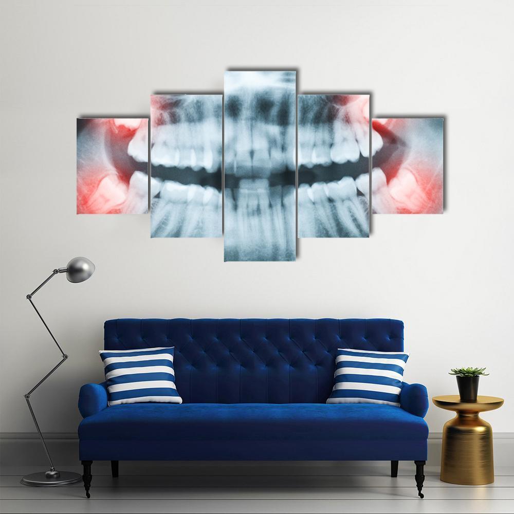 X-Ray Of Teeth And Mouth Canvas Wall Art-5 Star-Gallery Wrap-62" x 32"-Tiaracle