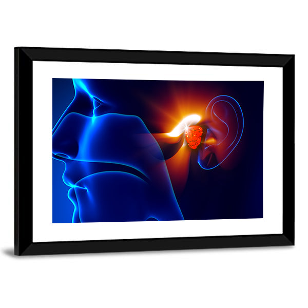 Human Ear Pain Illustration Canvas Wall Art