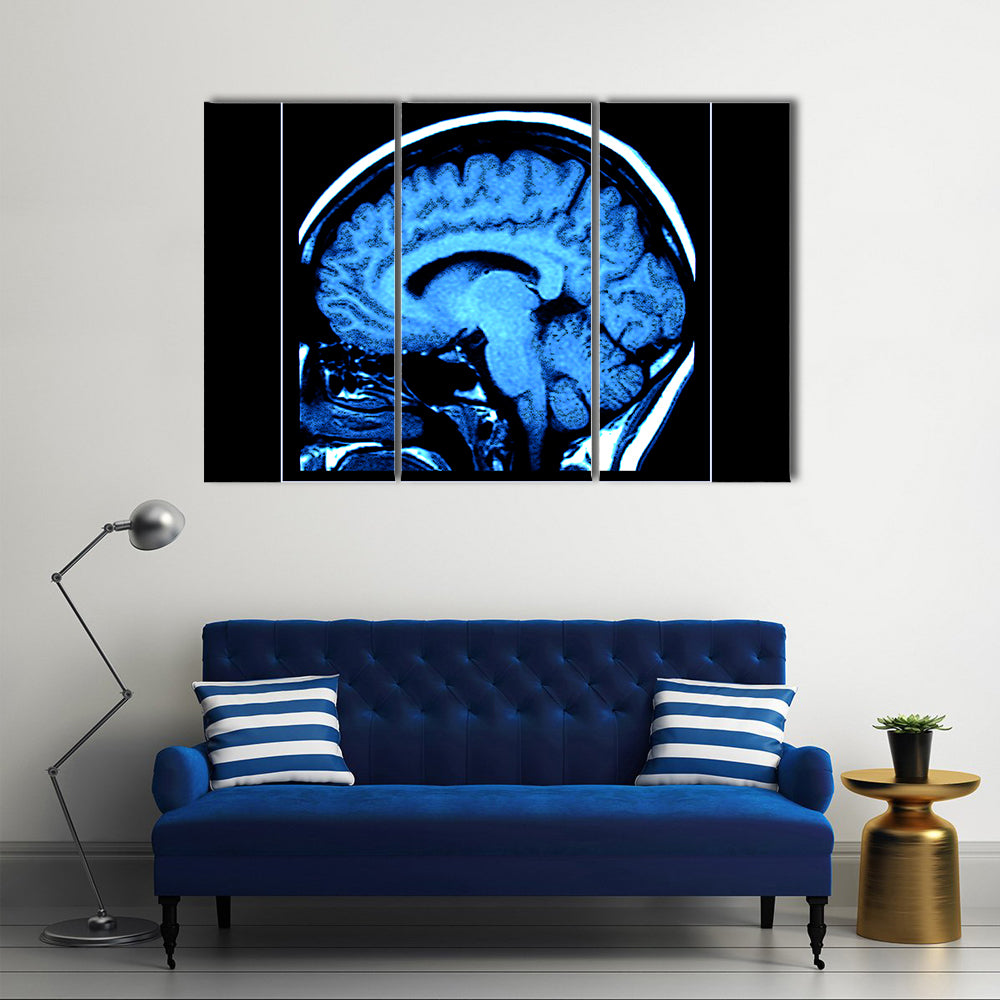 Mri Scan of the Human Brain Canvas Wall Art