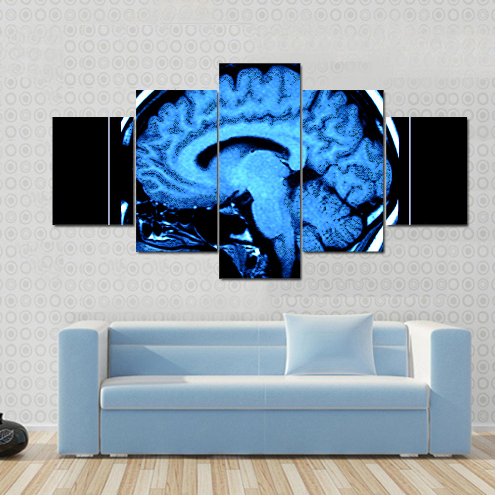 Mri Scan of the Human Brain Canvas Wall Art