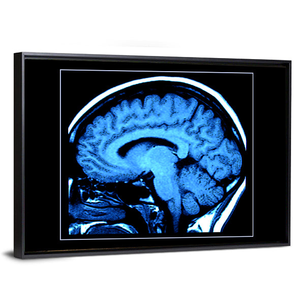 Mri Scan of the Human Brain Canvas Wall Art