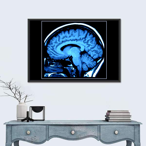 Mri Scan of the Human Brain Canvas Wall Art