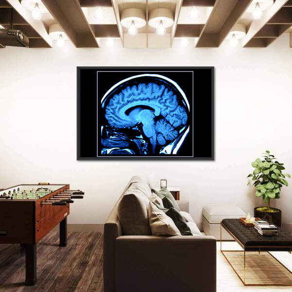 Mri Scan of the Human Brain Canvas Wall Art