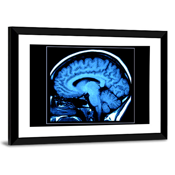 Mri Scan of the Human Brain Canvas Wall Art