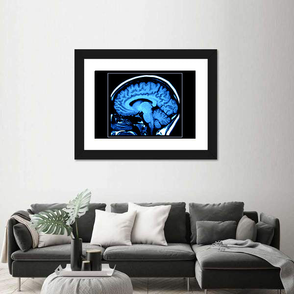 Mri Scan of the Human Brain Canvas Wall Art