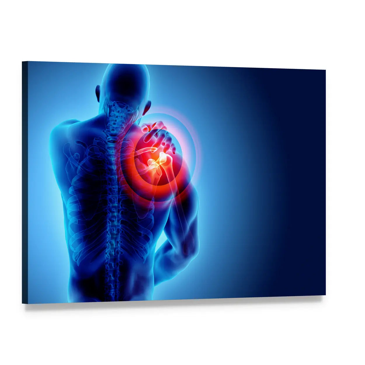 Anatomical Shoulder Pain Illustration Canvas Wall Art, single panel gallery wrapped canvas, angled product view