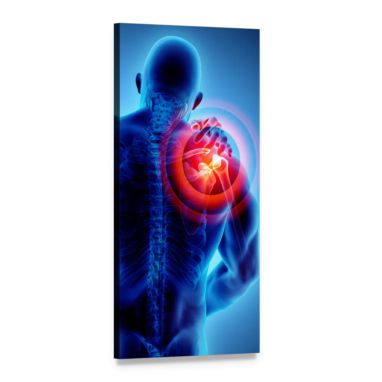 Shoulder Pain Skeleton X-ray Illustration Vertical Canvas Wall Art, 1 panel 1 Vertical layout gallery wrapped canvas set, angled product view