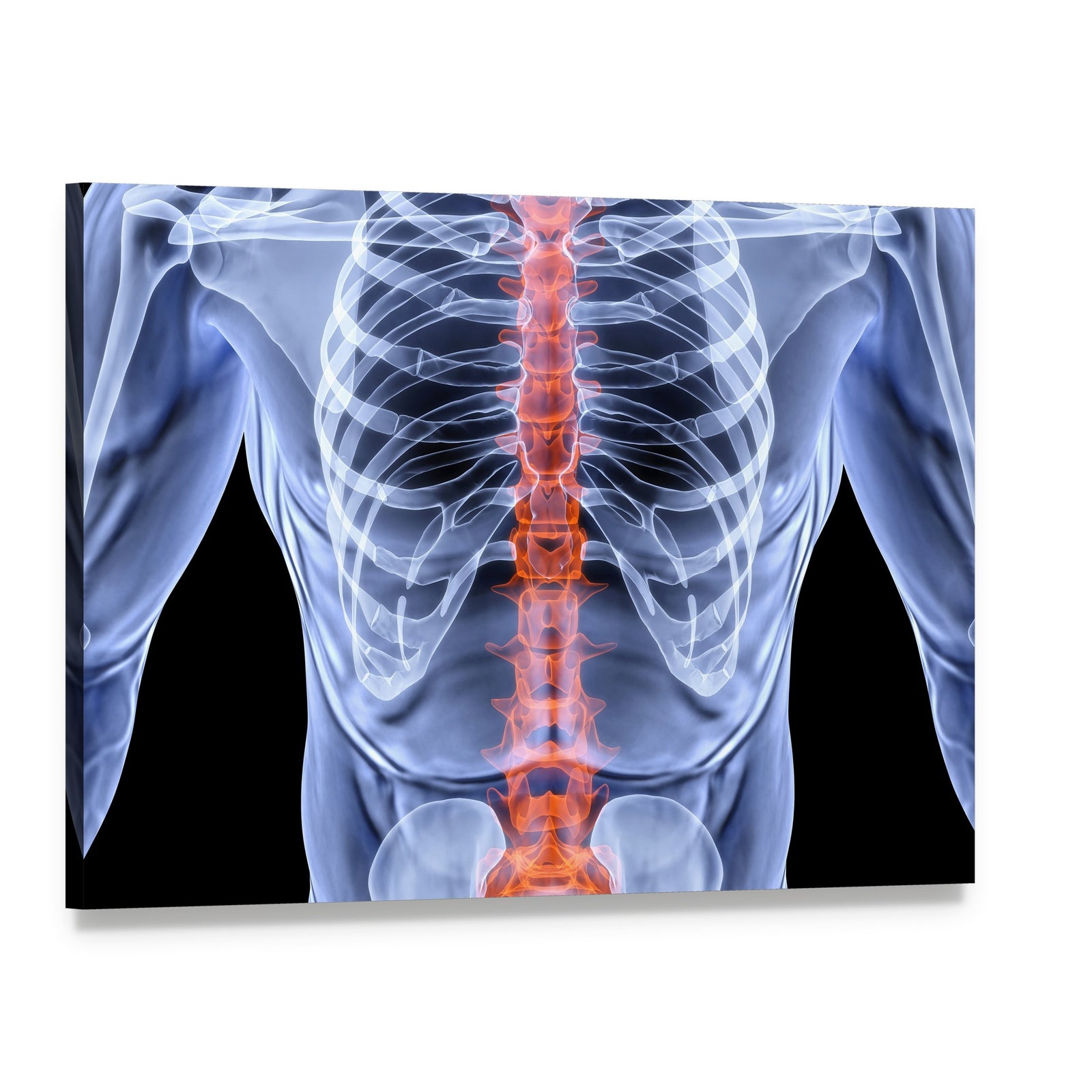 X-ray Male Spine with Glowing Red Vertebrae Canvas Wall Art, single panel gallery wrapped canvas, angled product view