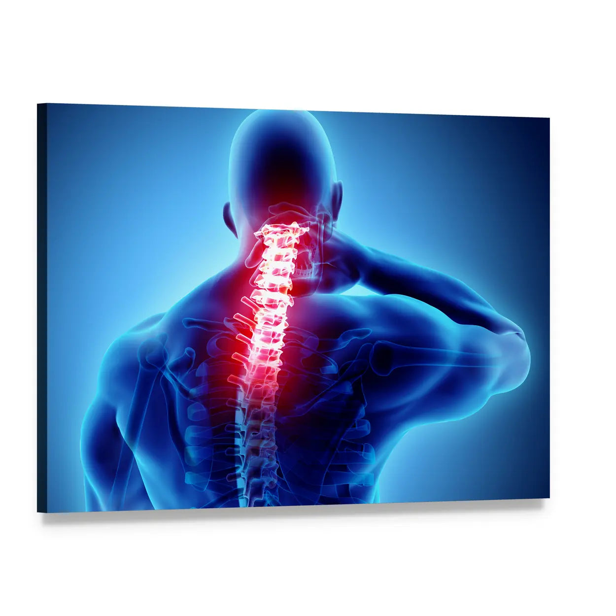 Cervical Spine Pain Illustration Canvas Wall Art, single panel gallery wrapped canvas, angled product view