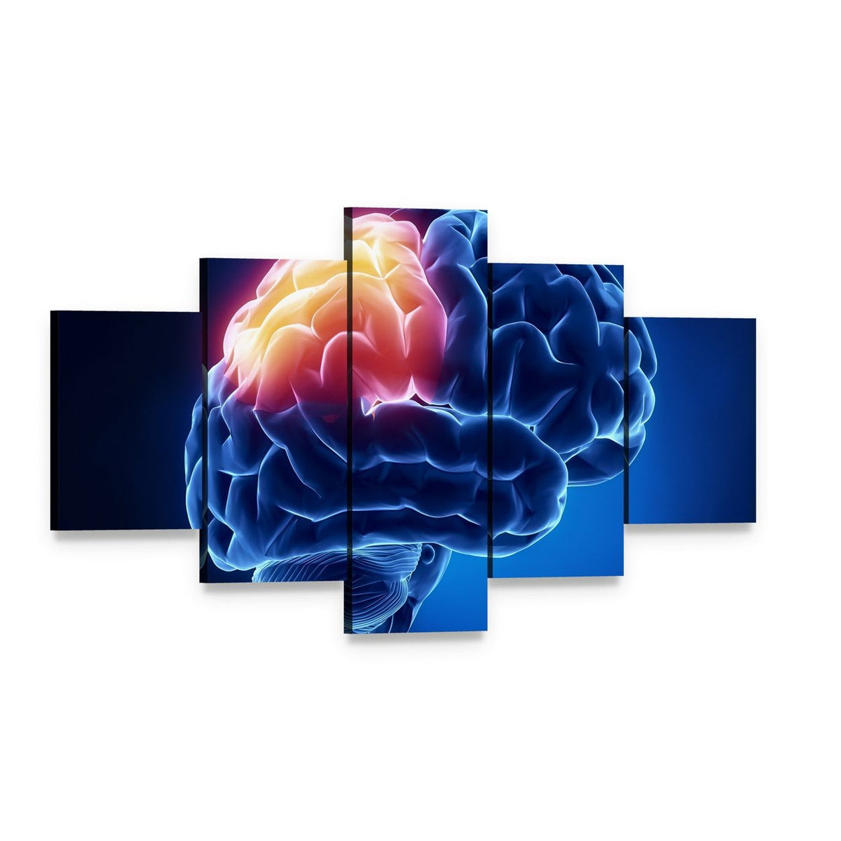 Human Brain X-ray Close-up Canvas Wall Art, 5 panel 5 Star layout gallery wrapped canvas set, angled product view