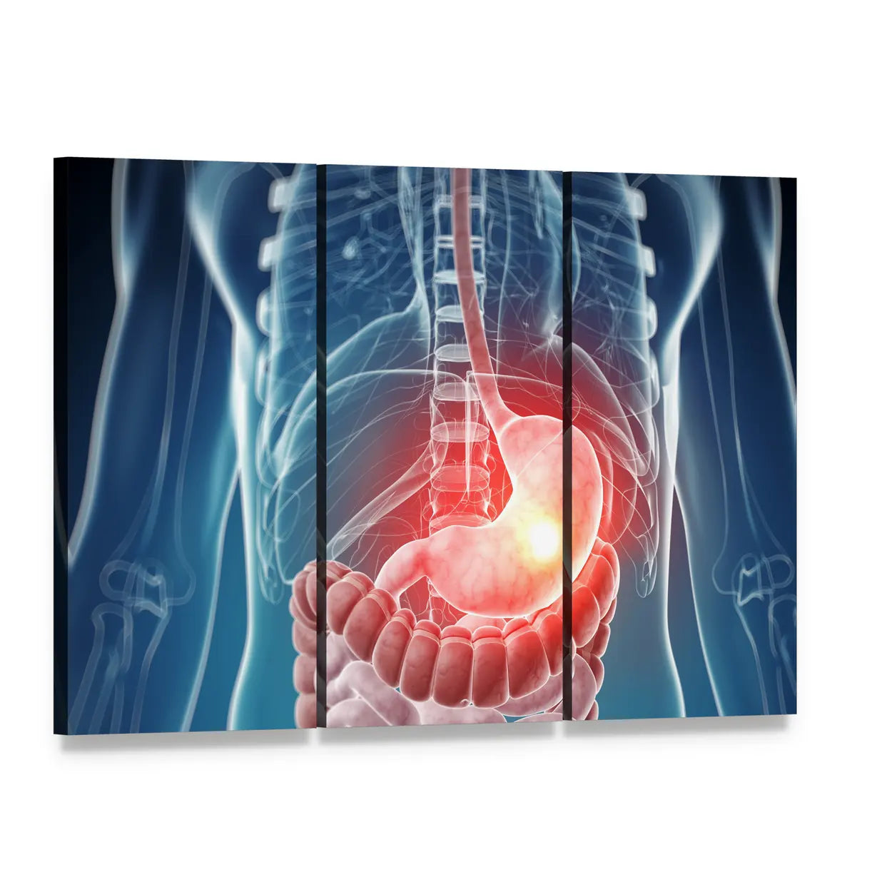 Painful Stomach Anatomical Illustration Canvas Wall Art, 3 panel 3 Horizontal layout gallery wrapped canvas set, angled product view