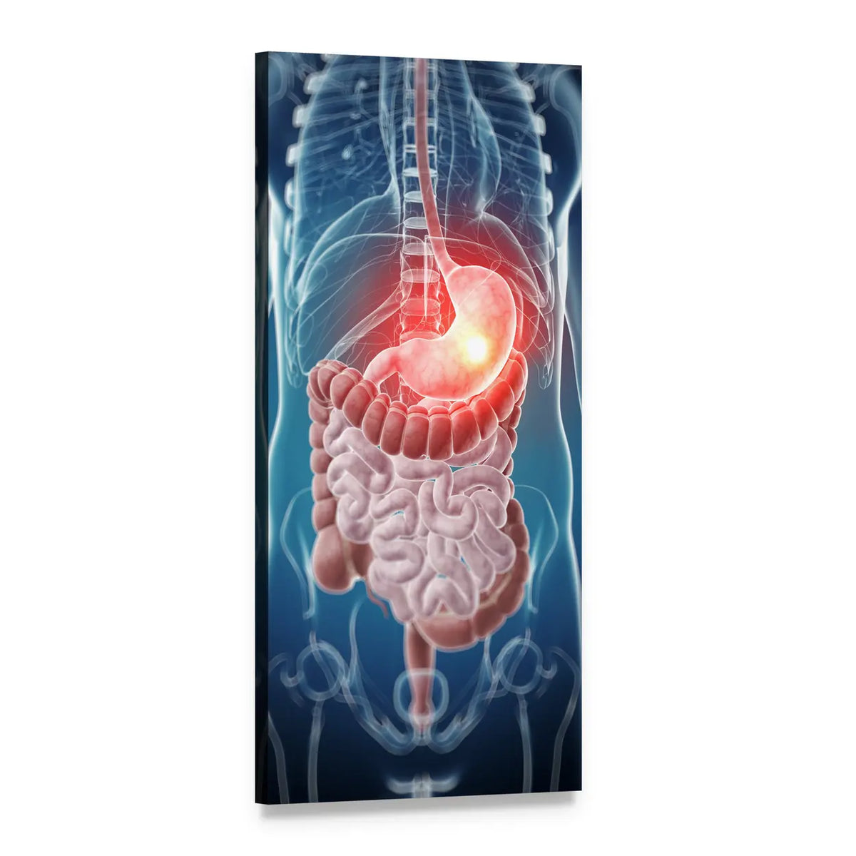Stomach Pain Medical Illustration Vertical Canvas Wall Art, 1 panel 1 Vertical layout gallery wrapped canvas set, angled product view
