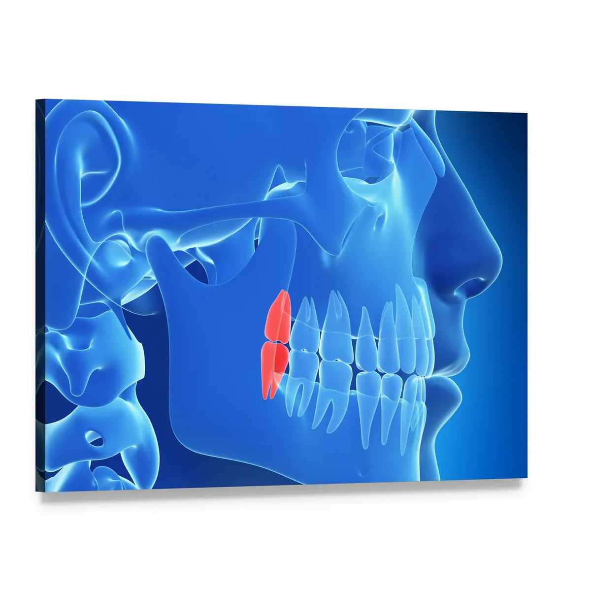 Translucent Skull with Highlighted Molars Canvas Wall Art, single panel gallery wrapped canvas, angled product view