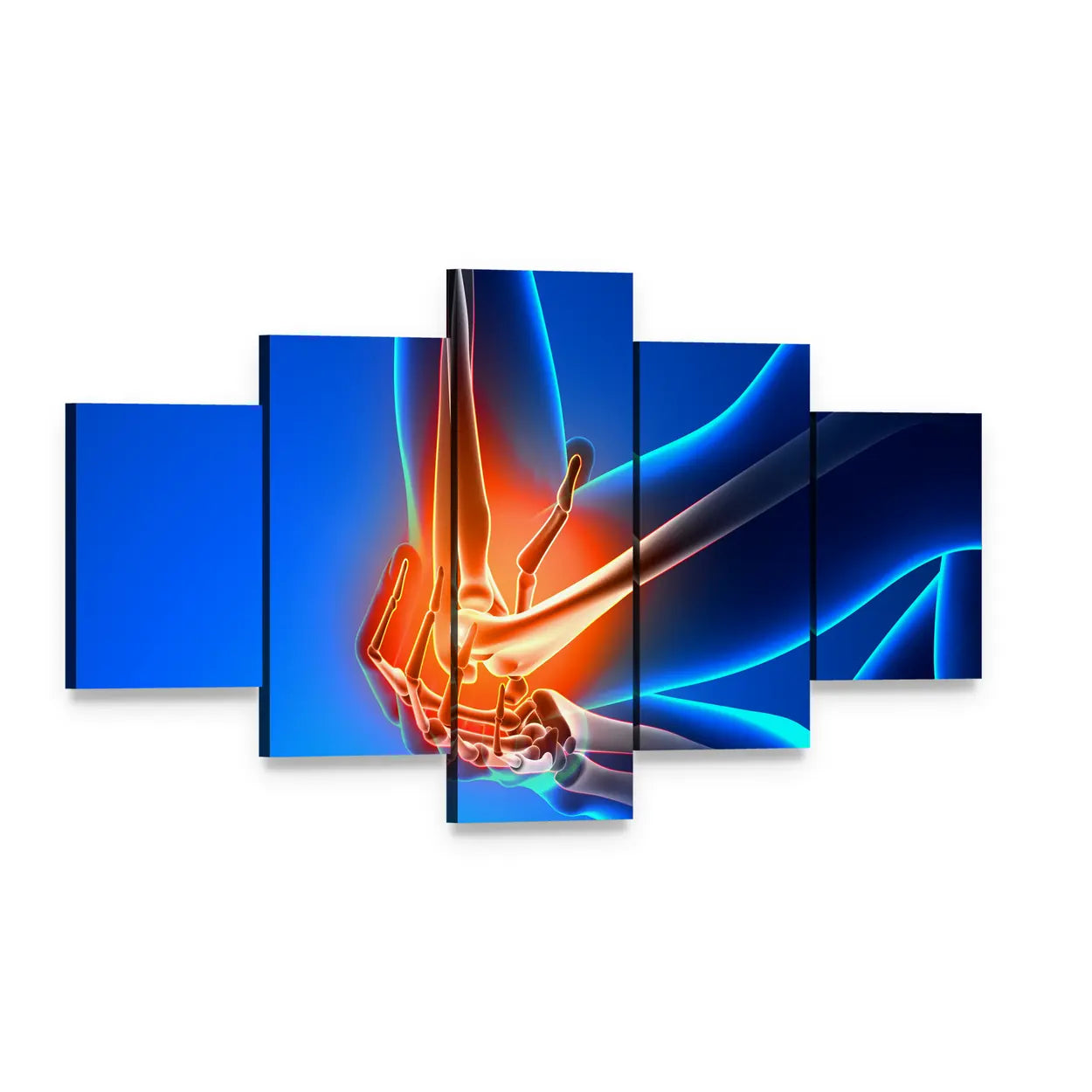 Elbow Joint Pain Illustration Canvas Wall Art, 5 panel 5 Star layout gallery wrapped canvas set, angled product view