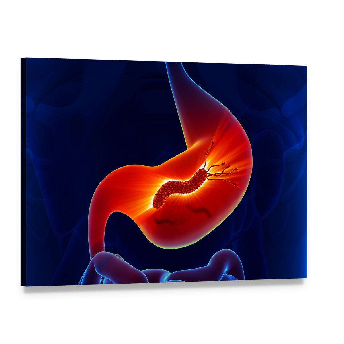 Stomach Lining Close-up Medical Illustration Canvas Wall Art, single panel gallery wrapped canvas, angled product view