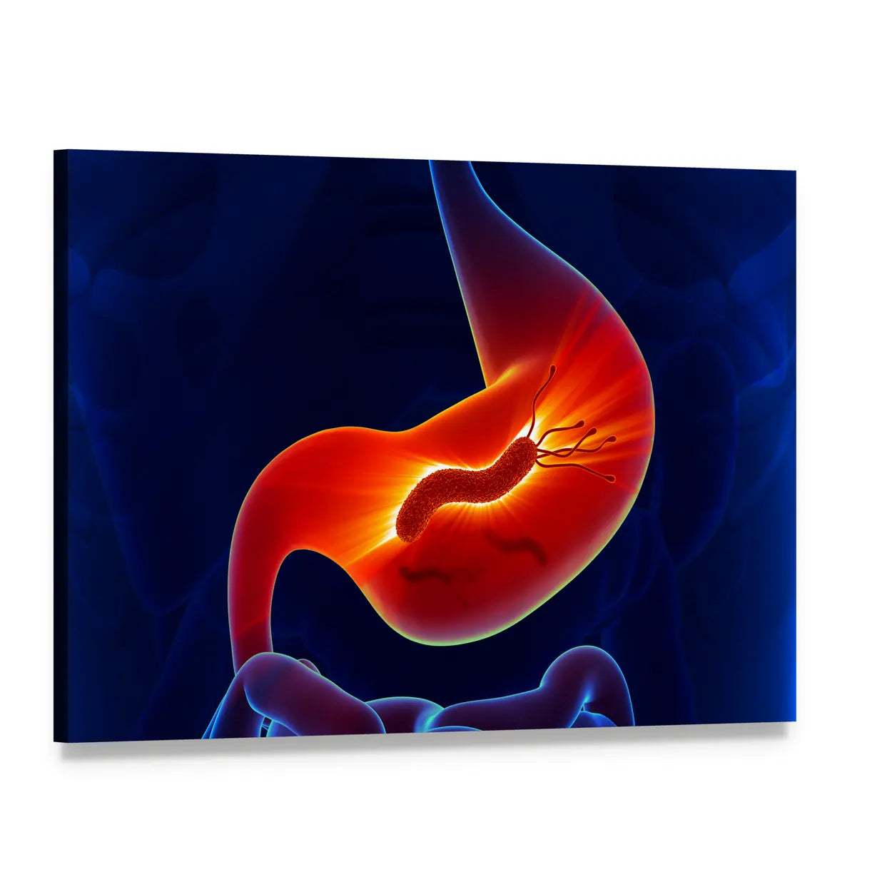 Stomach Cross-section with H. Pylori Canvas Wall Art, single panel gallery wrapped canvas, angled product view