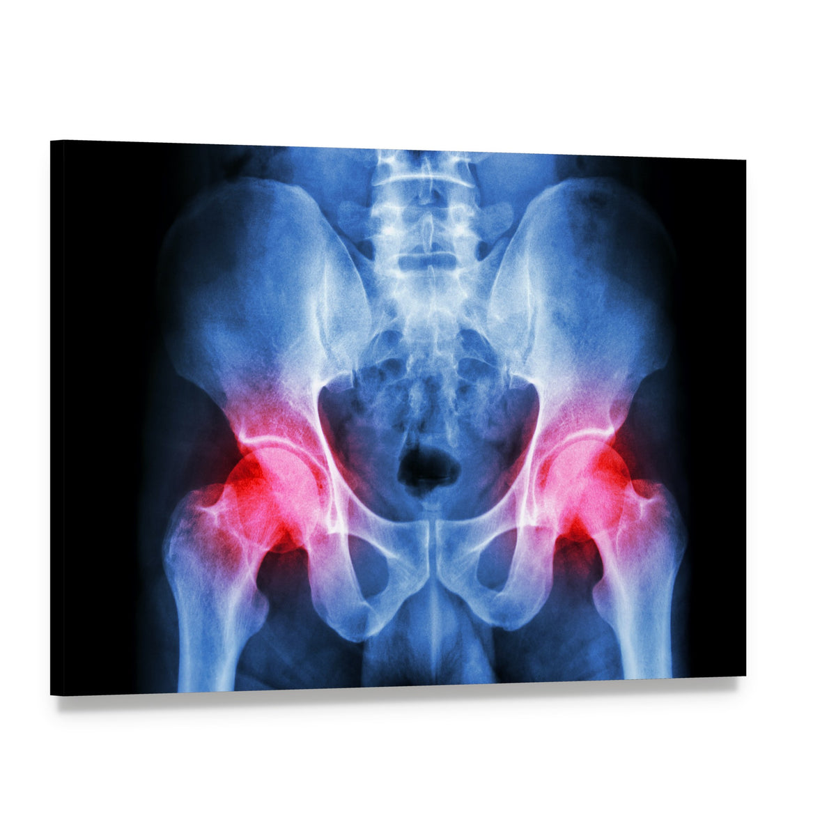 Pelvis X-ray Canvas Wall Art, single panel gallery wrapped canvas, angled product view