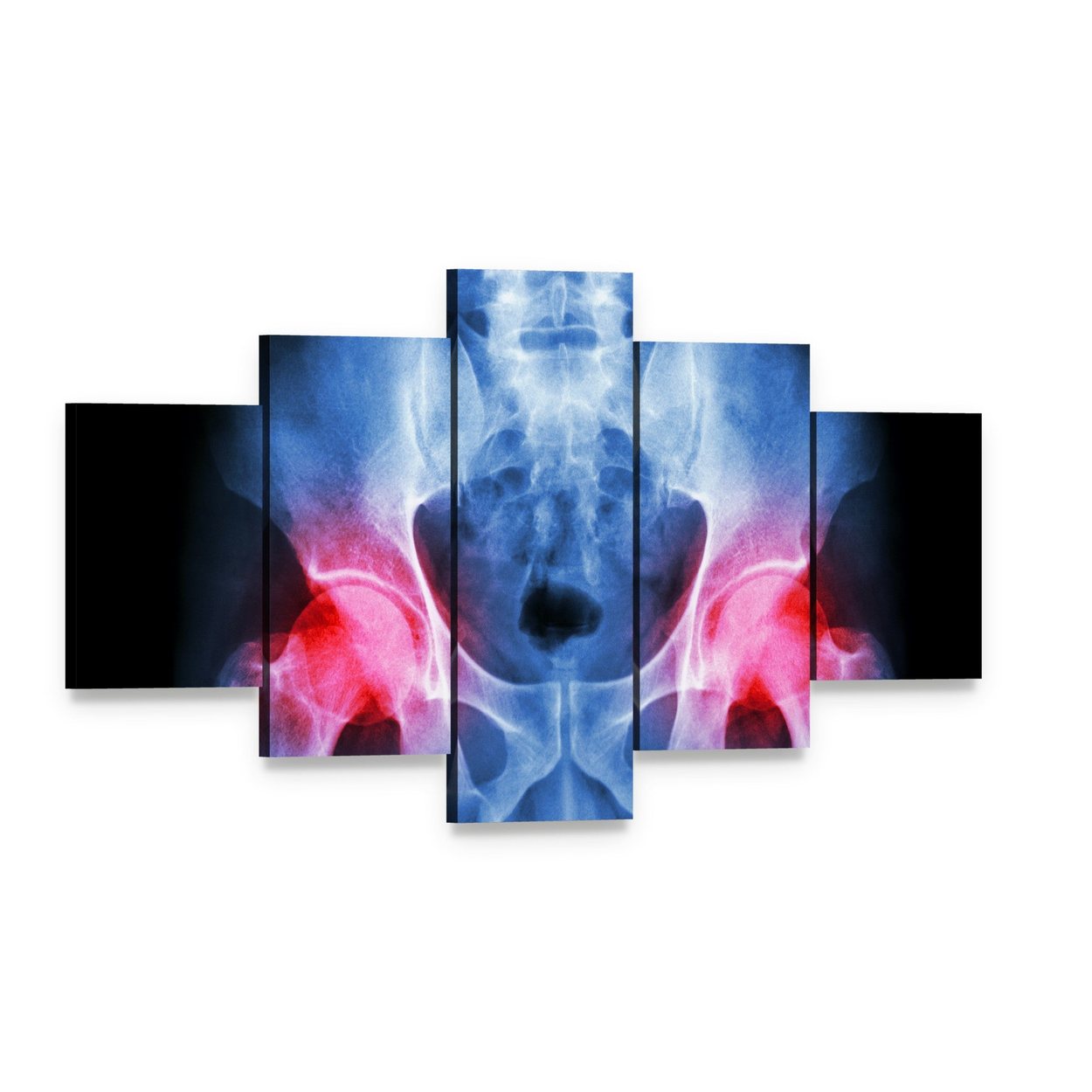 Pelvis X-ray Canvas Wall Art, 5 panel 5 Star layout gallery wrapped canvas set, angled product view
