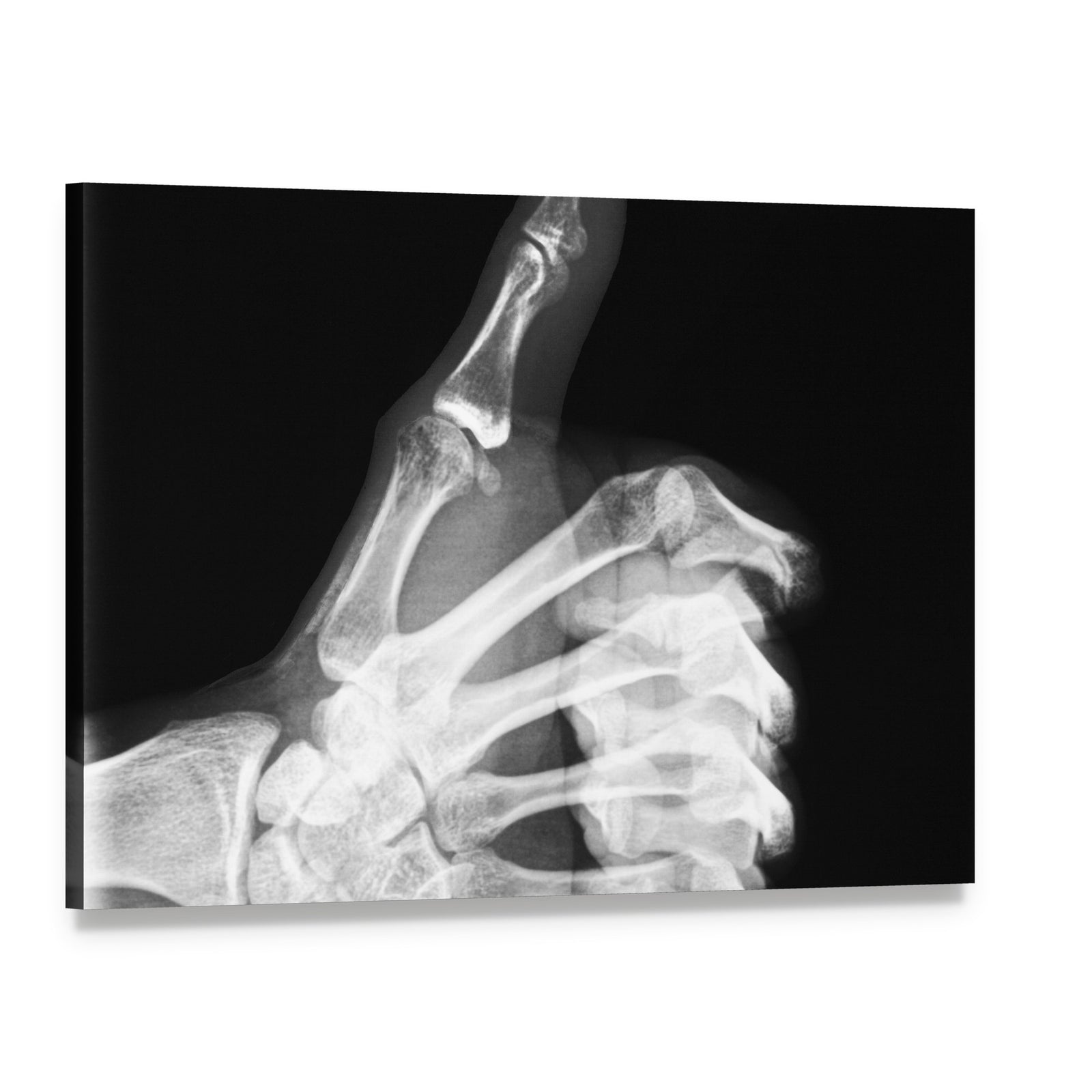 Thumb X-ray Study Canvas Wall Art, single panel gallery wrapped canvas, angled product view