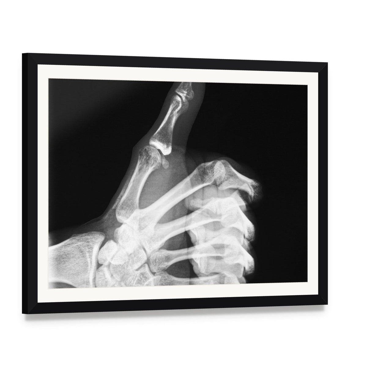 Thumb X-ray Study Canvas Wall Art, framed print with white mat and black frame, angled product view