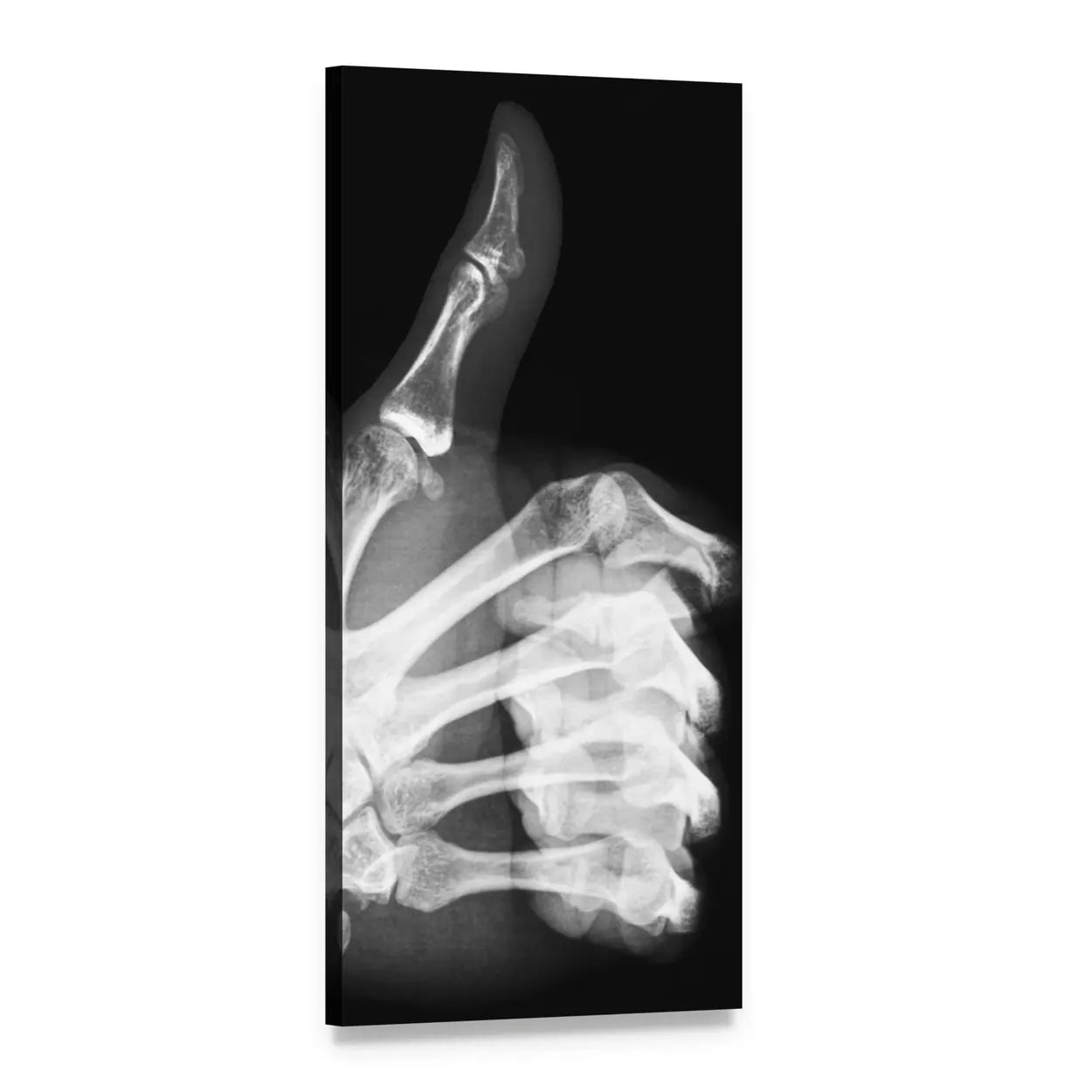 Thumbs-up Hand X-ray Vertical Canvas Wall Art, 1 panel 1 Vertical layout gallery wrapped canvas set, angled product view