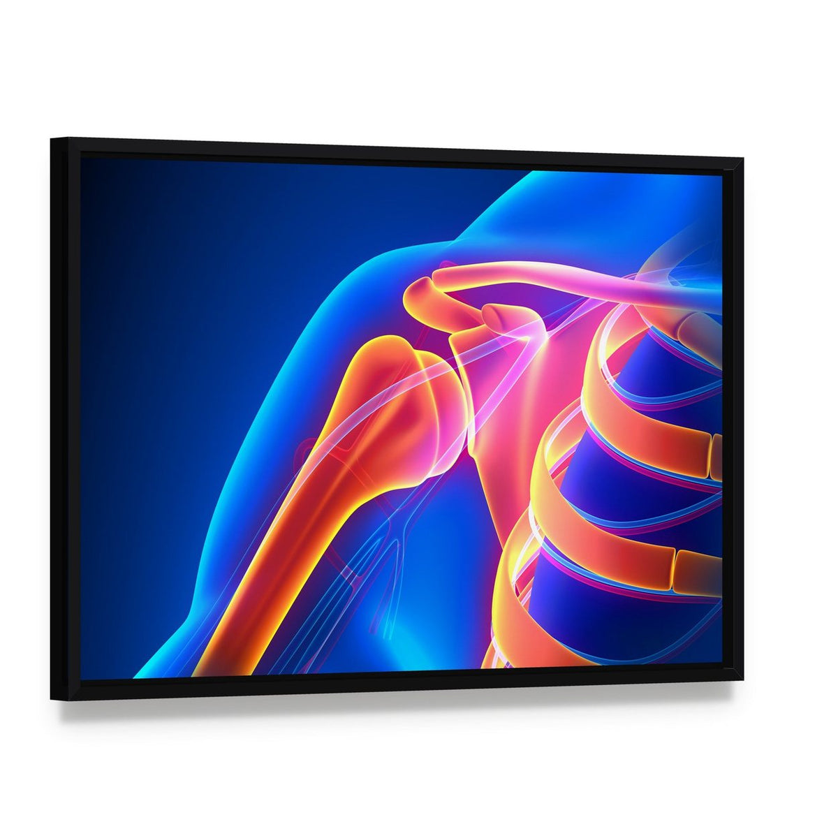 Glowing Shoulder Joint Anatomy Canvas Wall Art, framed canvas in a black floater frame, angled product view