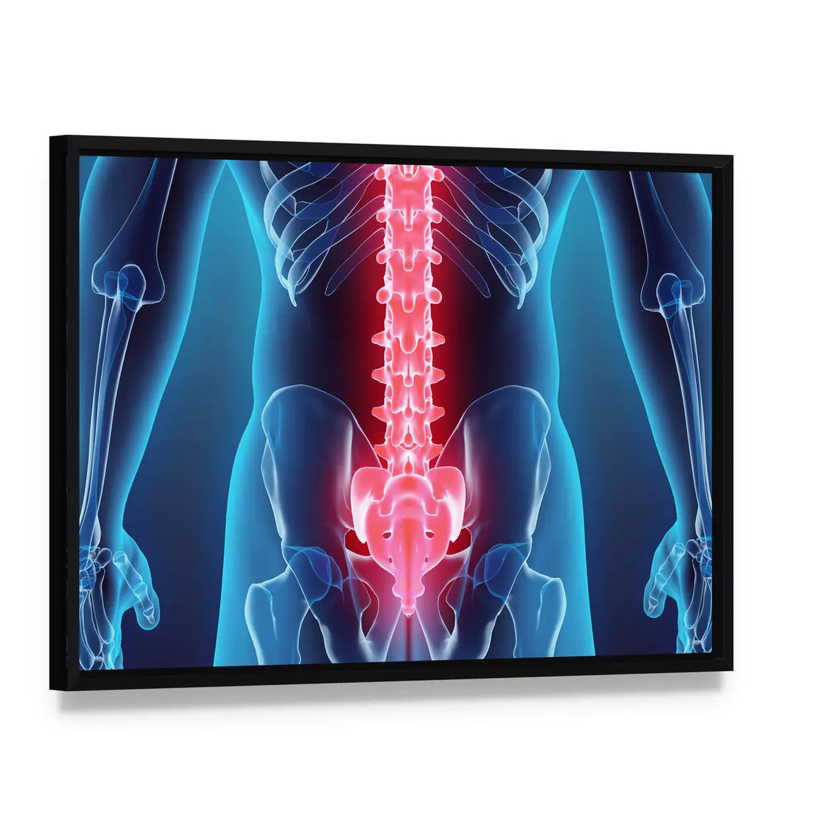 Anatomical Spine Illustration Canvas Wall Art, framed canvas in a black floater frame, angled product view