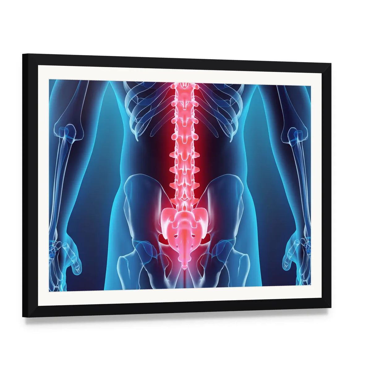 Anatomical Spine Illustration Canvas Wall Art, framed print with white mat and black frame, angled product view