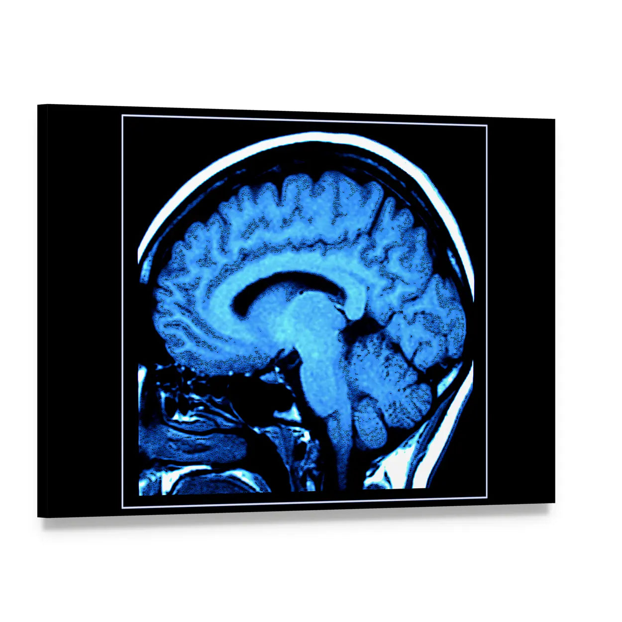 Mri Scan of the Human Brain Canvas Wall Art, single panel gallery wrapped canvas, angled product view