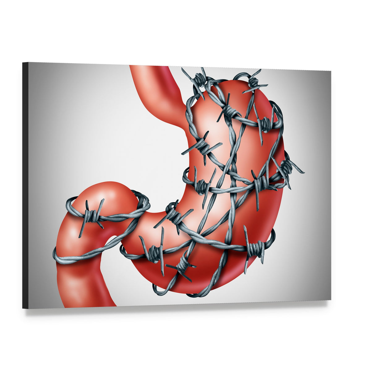 Human Stomach Wrapped in Barbed Wire Canvas Wall Art, single panel gallery wrapped canvas, angled product view