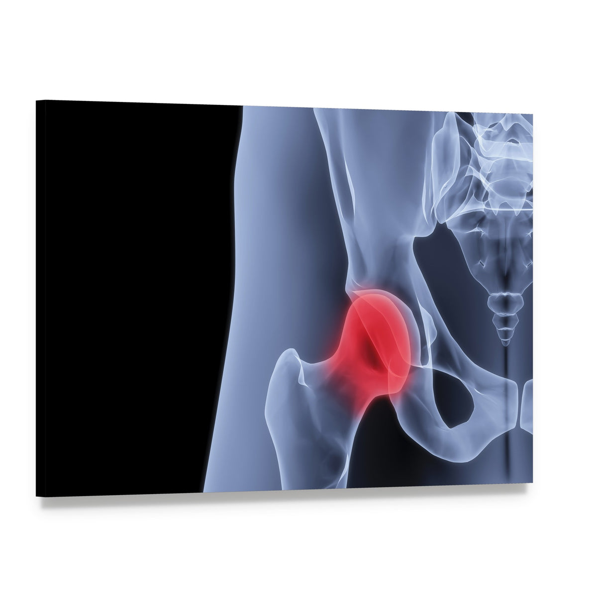 Pelvis X-ray Highlighting Hip Joint Canvas Wall Art, single panel gallery wrapped canvas, angled product view