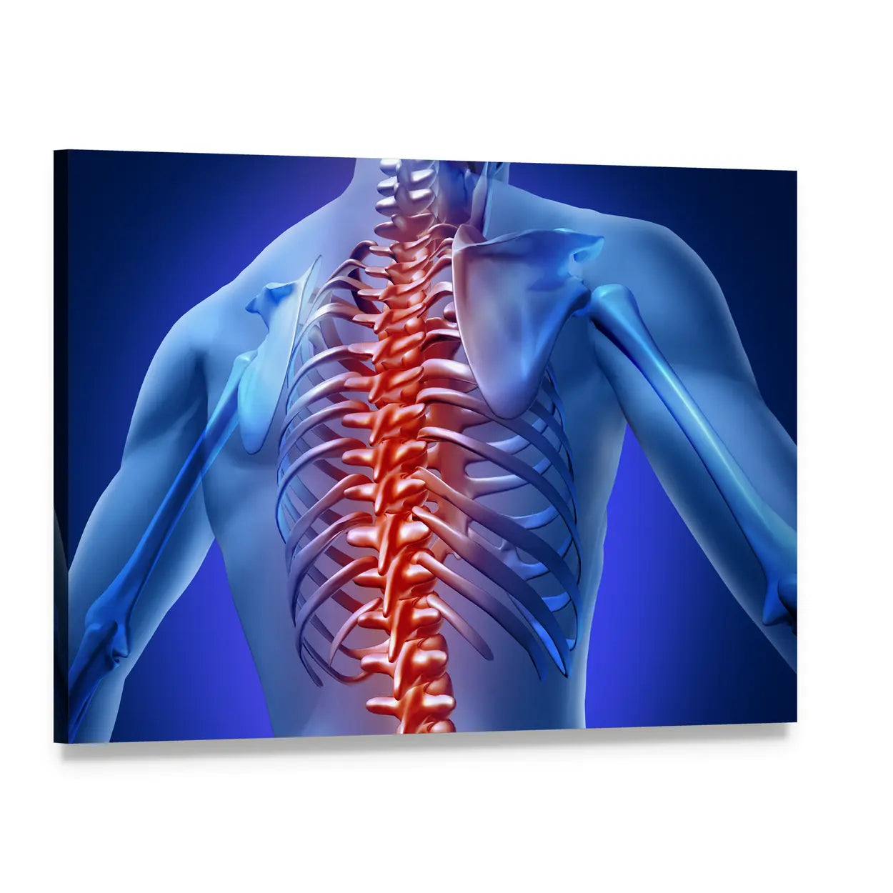 Anatomical Human Spine for Back Pain Canvas Wall Art, single panel gallery wrapped canvas, angled product view