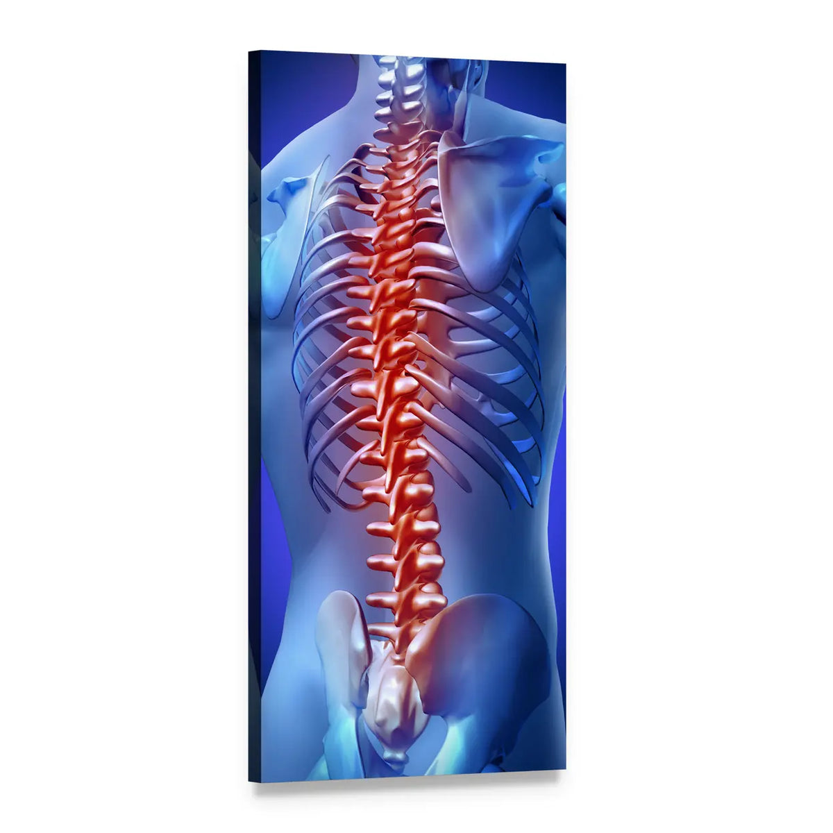 Glowing Spine Highlighting Back Pain Vertical Canvas Wall Art, 1 panel 1 Vertical layout gallery wrapped canvas set, angled product view