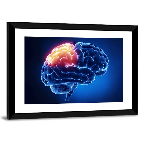 Human Brain X-ray Close-up Canvas Wall Art