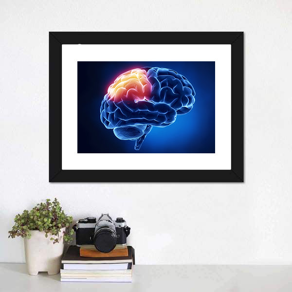 Human Brain X-ray Close-up Canvas Wall Art