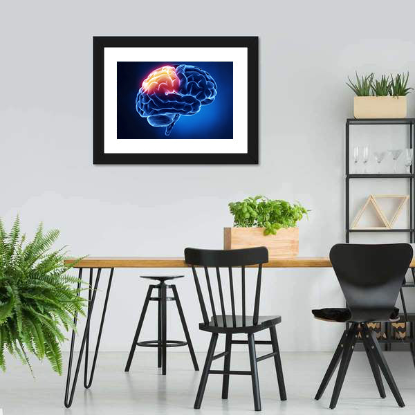 Human Brain X-ray Close-up Canvas Wall Art