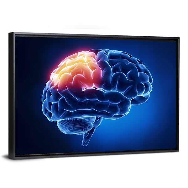 Human Brain X-ray Close-up Canvas Wall Art in black, orange and blue, framed canvas, product view on a white background