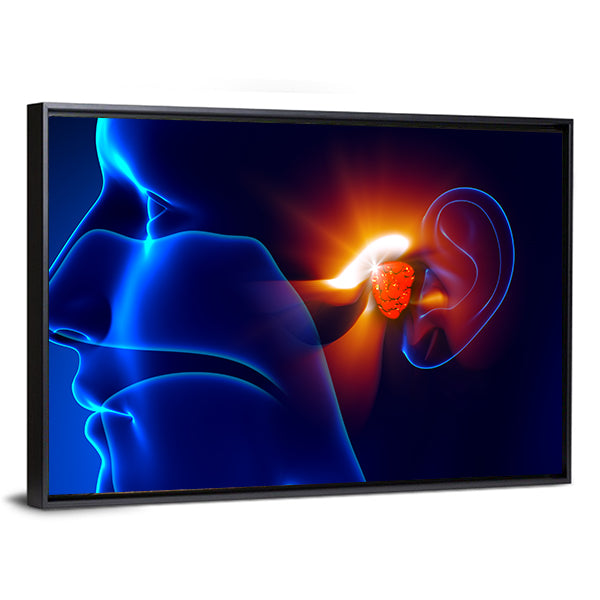 Human Ear Pain Illustration Canvas Wall Art