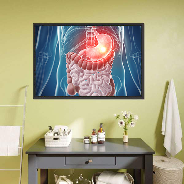 Painful Stomach Anatomical Illustration Canvas Wall Art