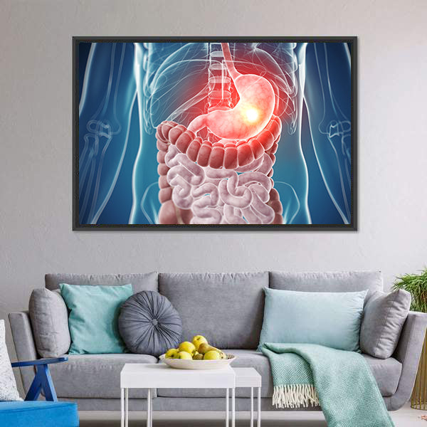 Painful Stomach Anatomical Illustration Canvas Wall Art