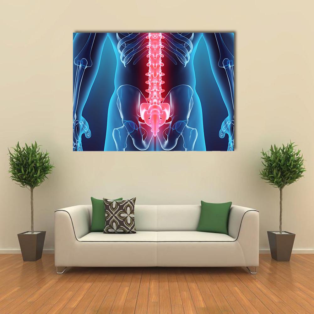 Lumbar Spine Illustration Canvas Wall Art in red and blue, single panel hung on a wall