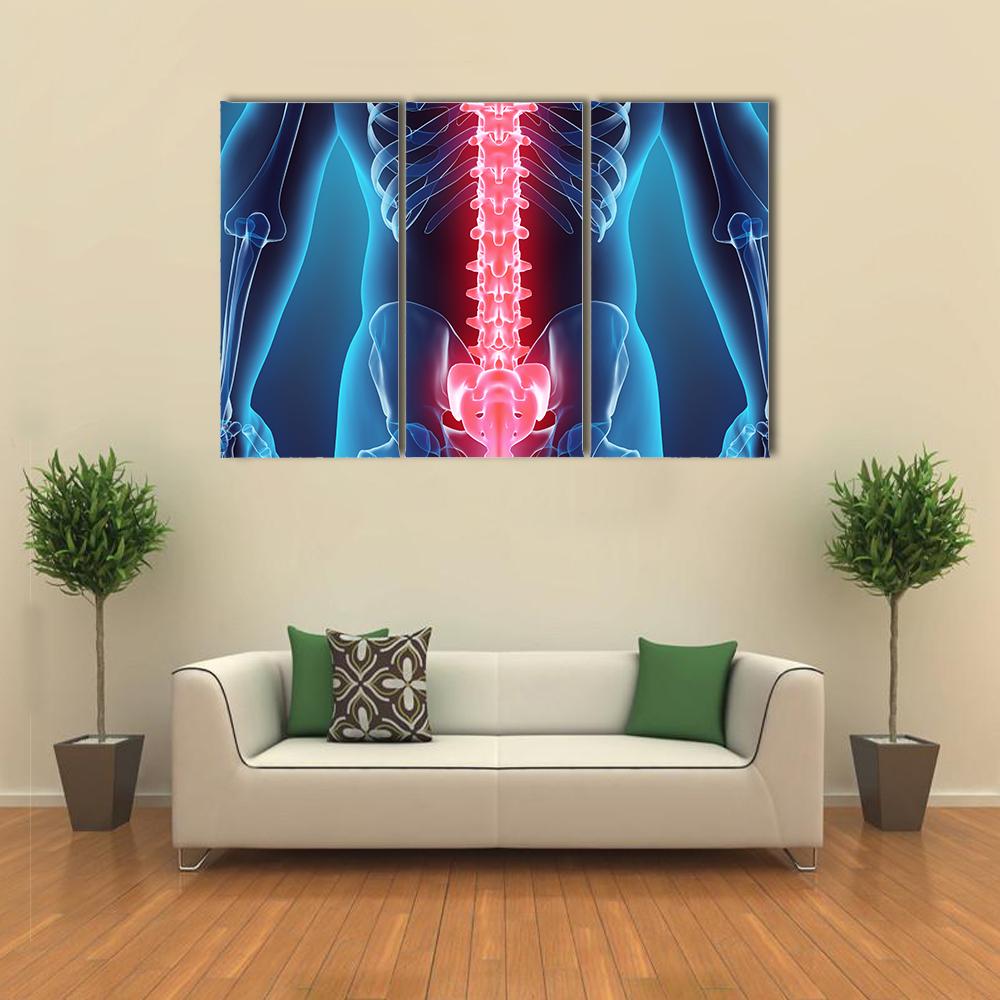 Spine Illustration Canvas Wall Art-3 Horizontal-Gallery Wrap-25" x 16"-Tiaracle