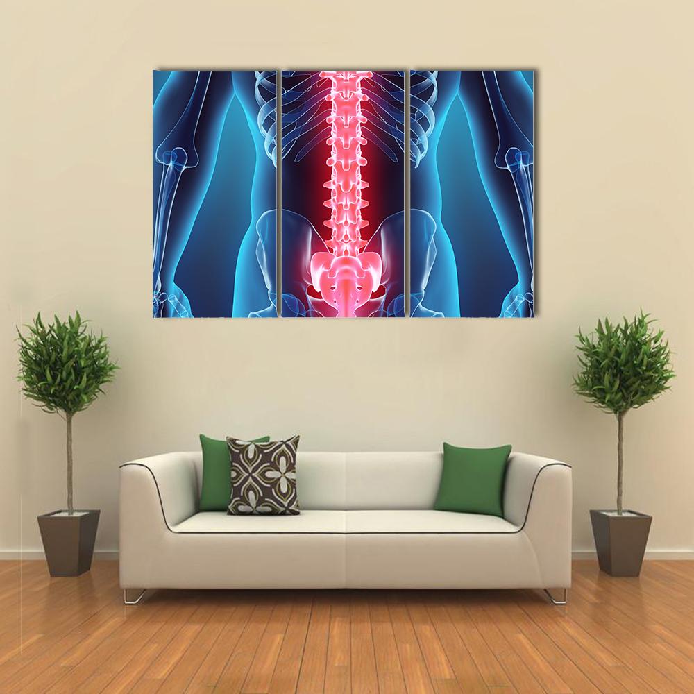 Spine Illustration Canvas Wall Art-1 Piece-Gallery Wrap-24" x 16"-Tiaracle