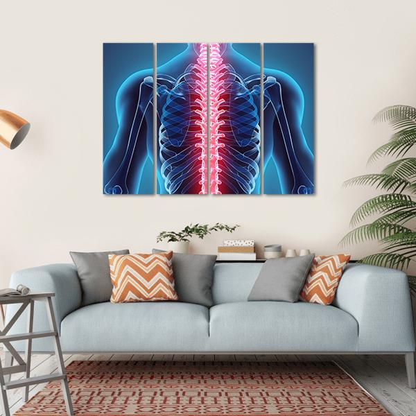 Spine Illustration Canvas Wall Art-4 Horizontal-Gallery Wrap-34" x 24"-Tiaracle