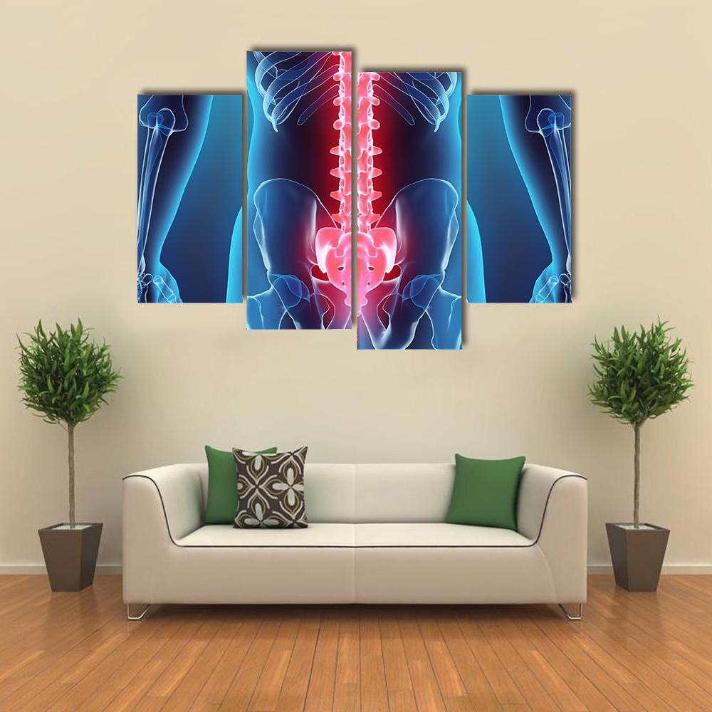 Spine Illustration Canvas Wall Art-4 Pop-Gallery Wrap-34" x 20"-Tiaracle