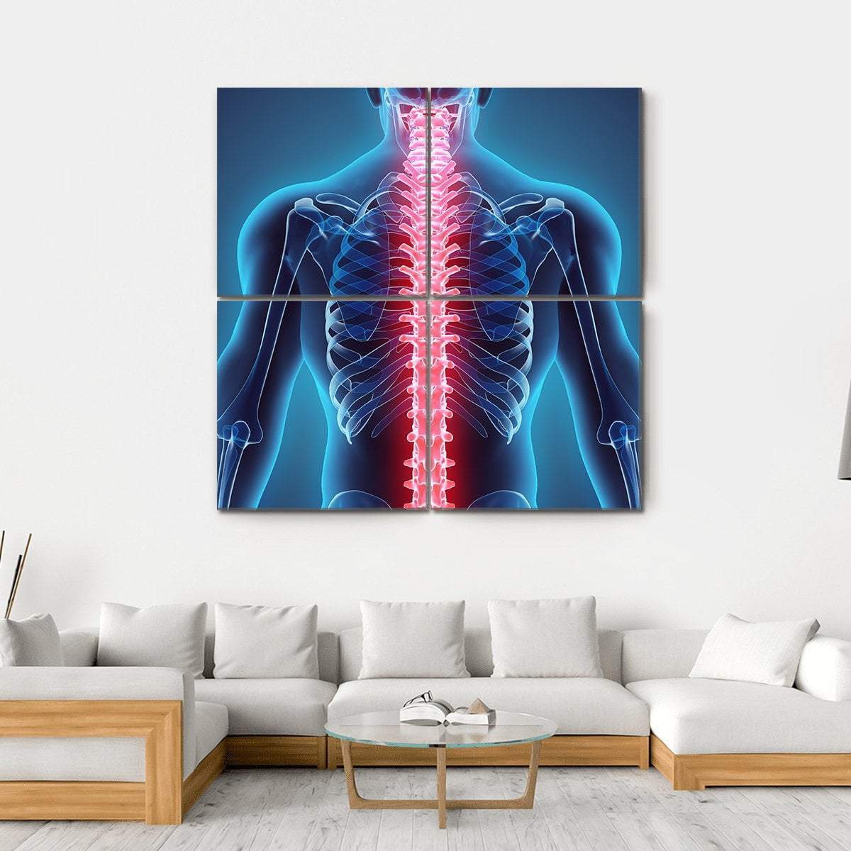 Spine Illustration Canvas Wall Art-4 Square-Gallery Wrap-17" x 17"-Tiaracle