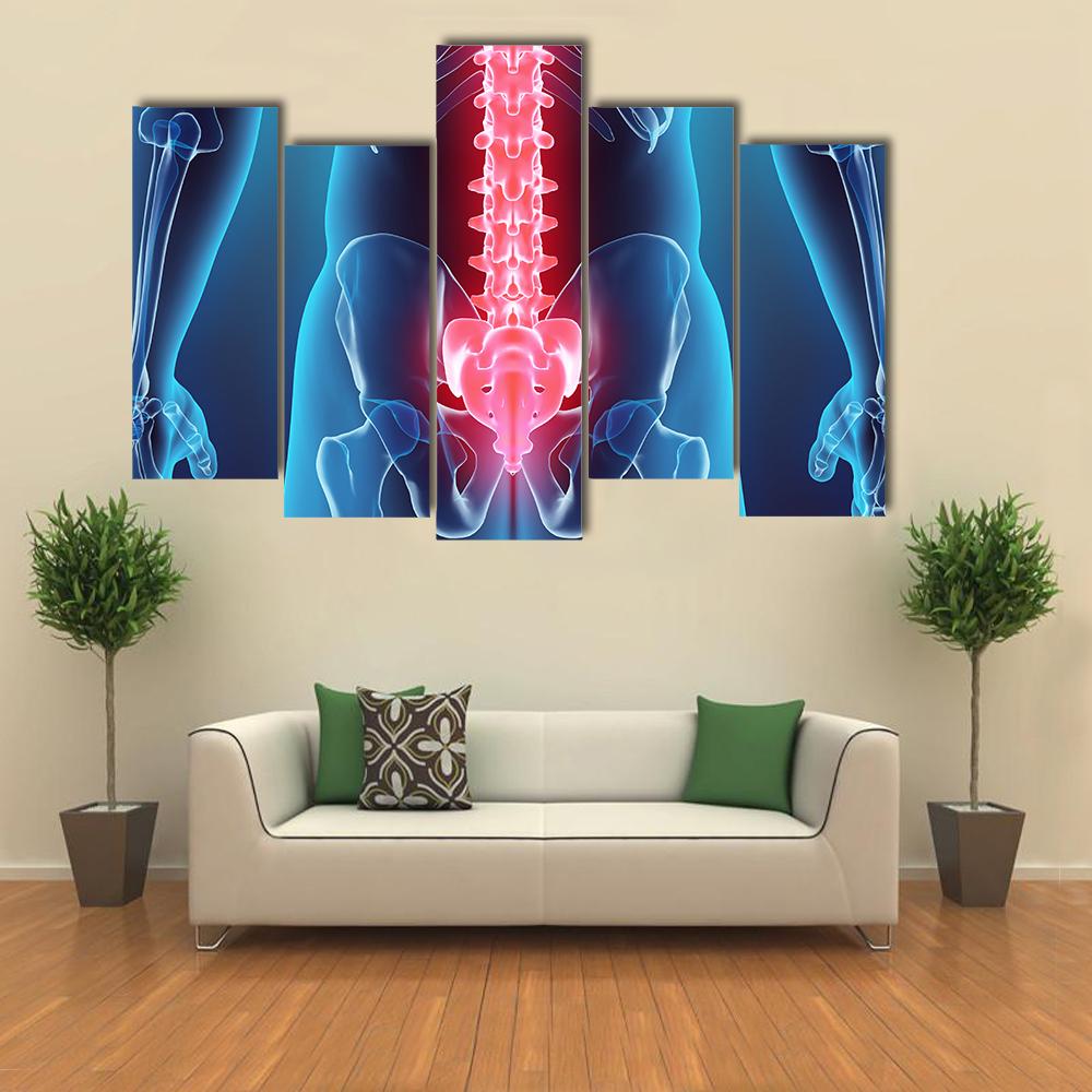 Spine Illustration Canvas Wall Art-5 Pop-Gallery Wrap-32" x 21"-Tiaracle