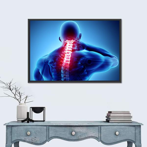 Painful Neck With Cervical Spine Skeleton X-Ray Canvas Wall Art-1 Piece-Floating Frame-24" x 16"-Tiaracle